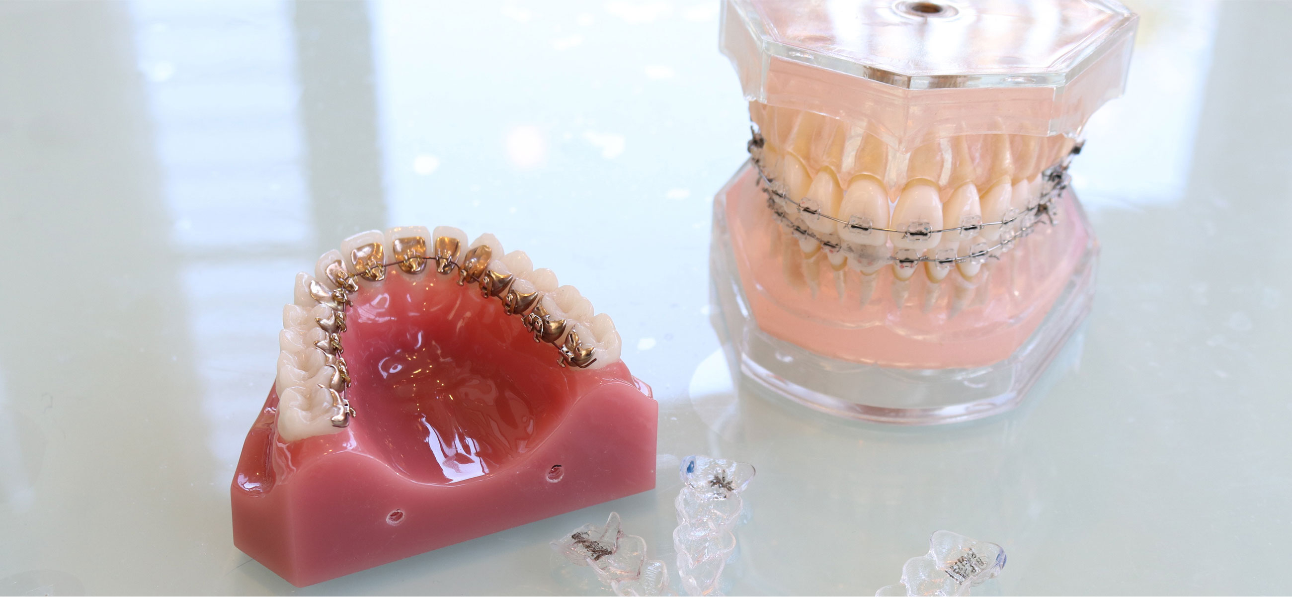 矯正歯科ならではの多様な矯正装置
