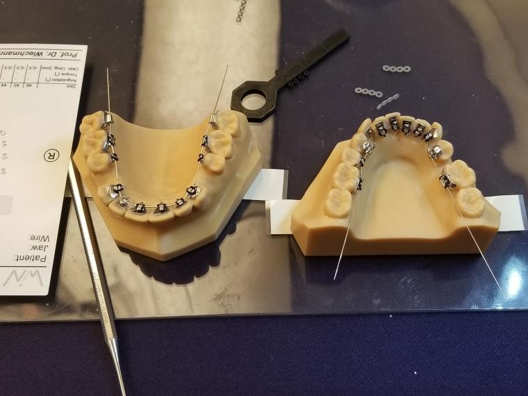 裏側矯正装置の勉強会に参加してきました‐鶴ヶ峰の矯正歯科　たけのうち矯正歯科