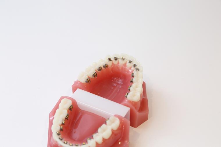 裏側(舌側)からの矯正治療について‐鶴ヶ峰の矯正歯科　たけのうち矯正歯科